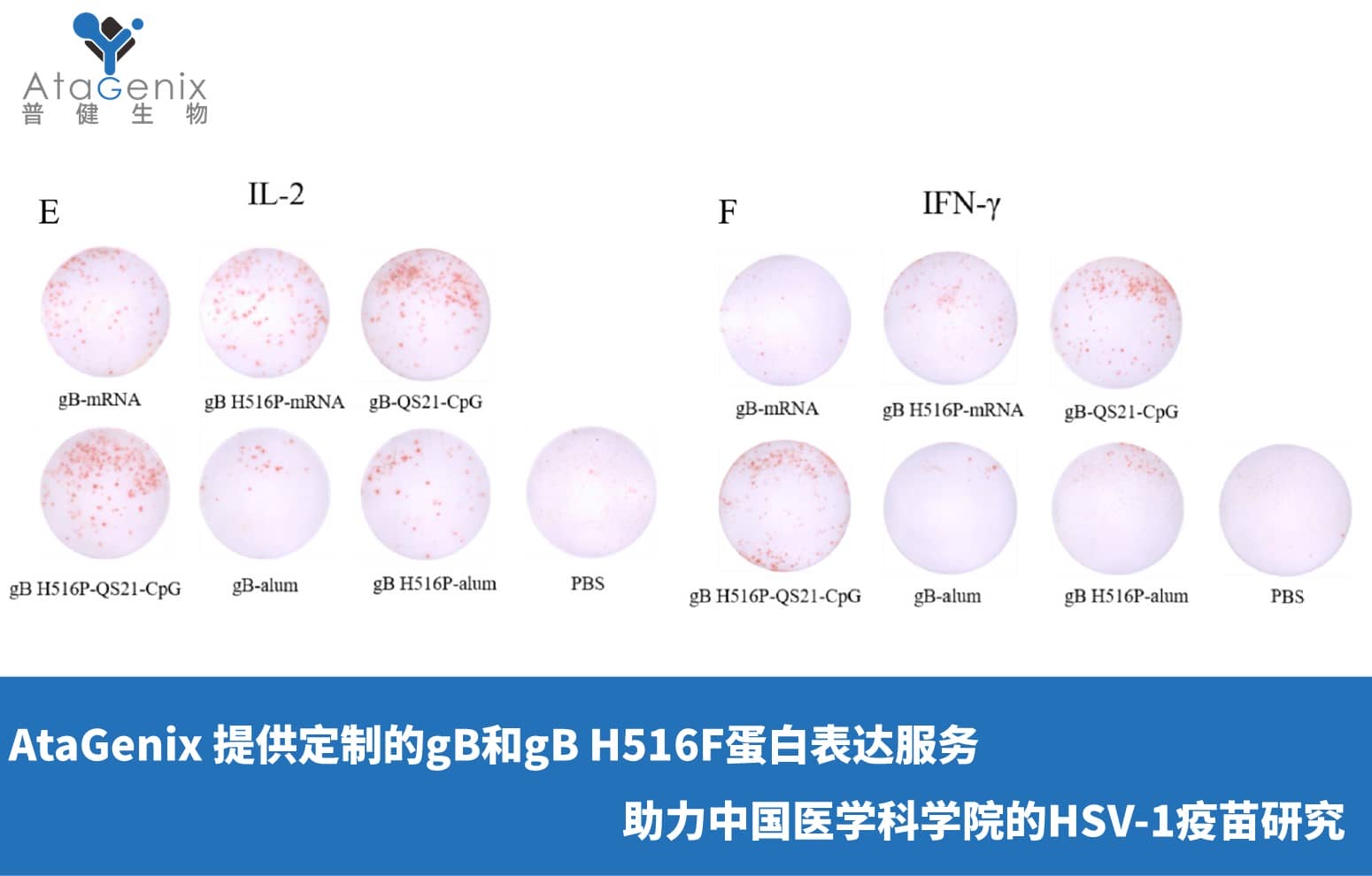 AtaGenix 提供定制gB和gB H516F蛋白表達(dá)服務(wù)，助力中國醫(yī)學(xué)科學(xué)院HSV-1疫苗研究