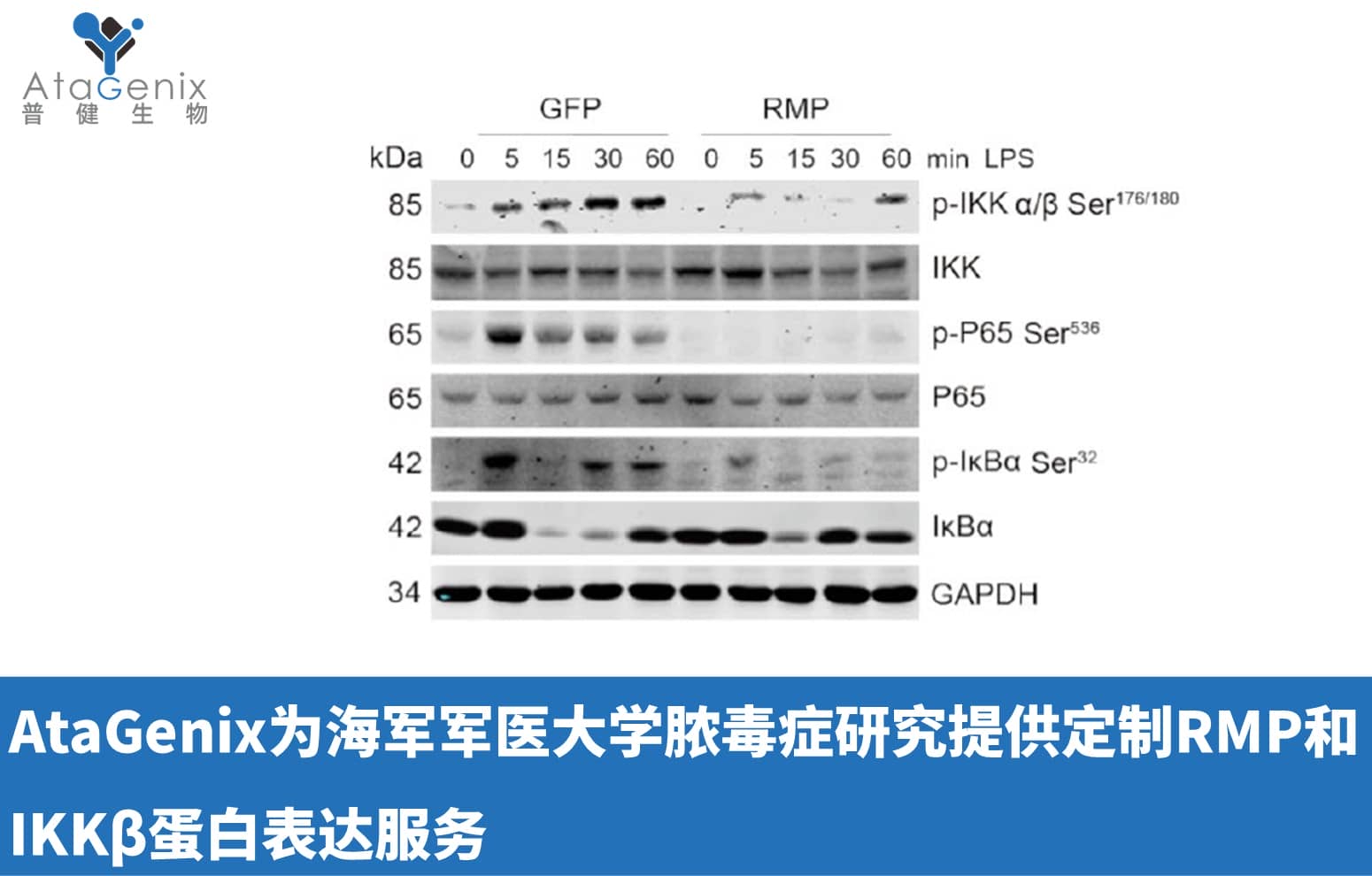 AtaGenix為海軍軍醫(yī)大學(xué)膿毒癥研究提供定制RMP和IKKβ蛋白表達(dá)服務(wù)