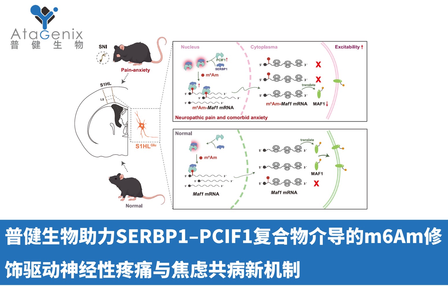 普健生物助力SERBP1–PCIF1復(fù)合物介導(dǎo)的m6Am修飾驅(qū)動神經(jīng)性疼痛與焦慮共病新機制